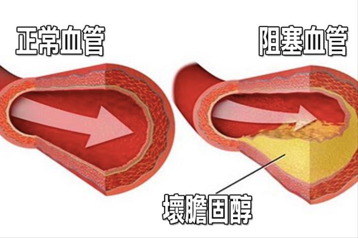 关于胆固醇的最新研究，揭示胆固醇的真相与未来研究方向